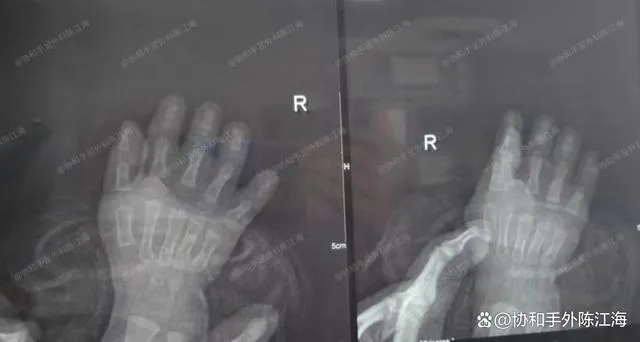 info-640-342 info-640-342